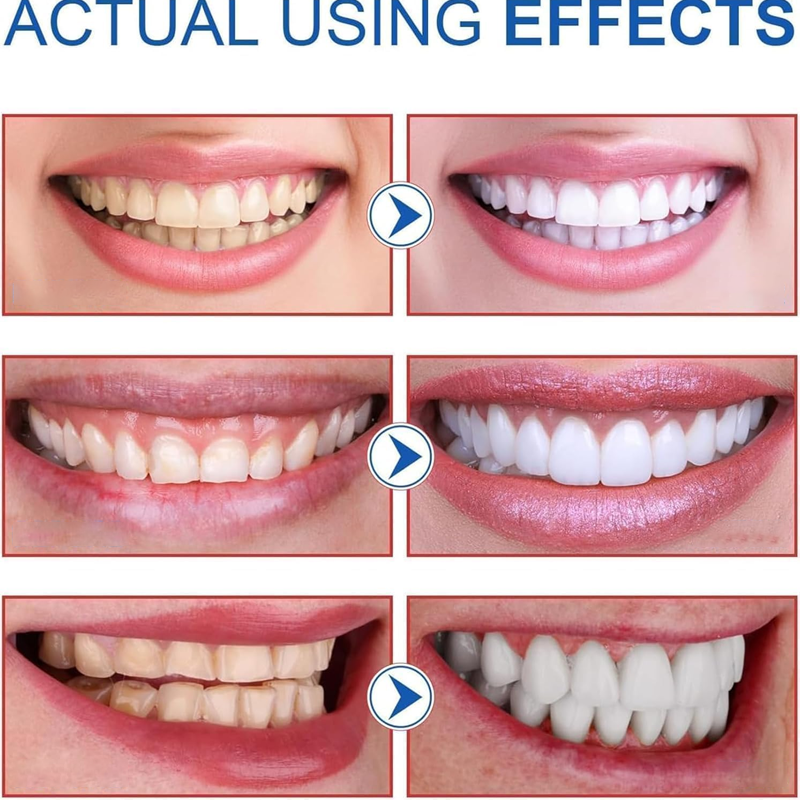 ✨SP-8 Probiotic Whitening Toothpaste🦷 Your Secret to a Brighter, Healthier Smile 🍃