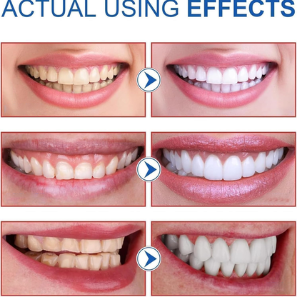 ✨SP-8 Probiotic Whitening Toothpaste🦷 Your Secret to a Brighter, Healthier Smile 🍃