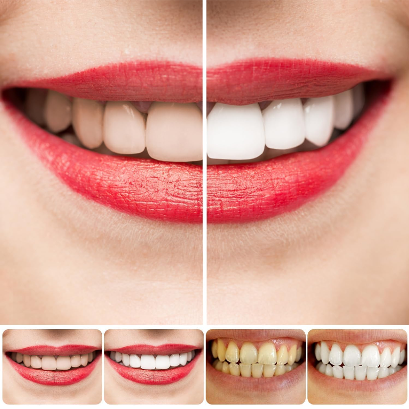 ✨SP-8 Probiotic Whitening Toothpaste🦷 Your Secret to a Brighter, Healthier Smile 🍃