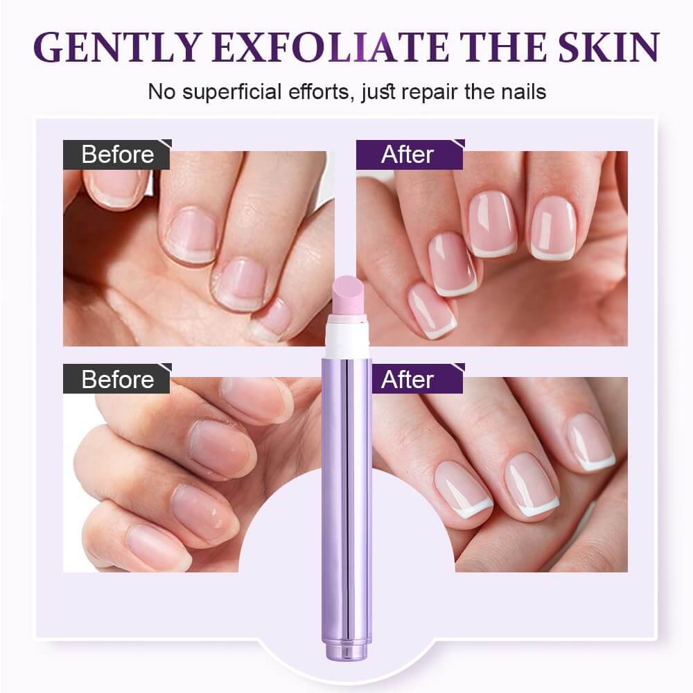 ✨Ceramic Cuticle Pen – 45° Angled Tip, Nourishing Oil, Salon Results at Home
